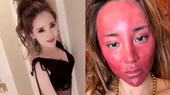 22년간 화장 안 지운 여성의 최후... 착색된 피부 딱딱하게 굳었다