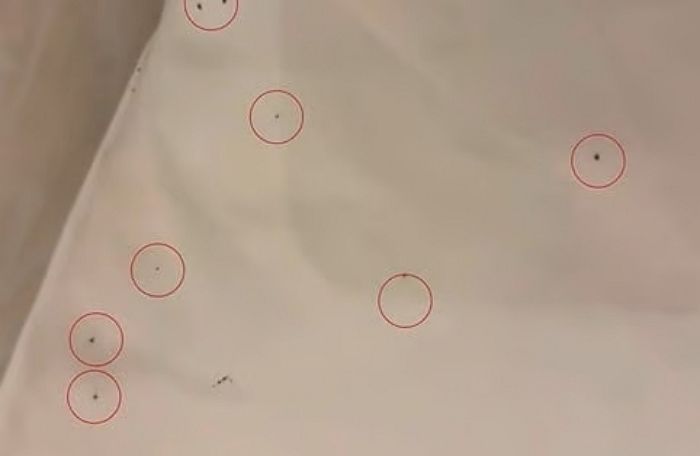 대구서 호텔에 묵었다가 병원행... 불 켜보니 이불 위에 ‘이것’ 바글바글