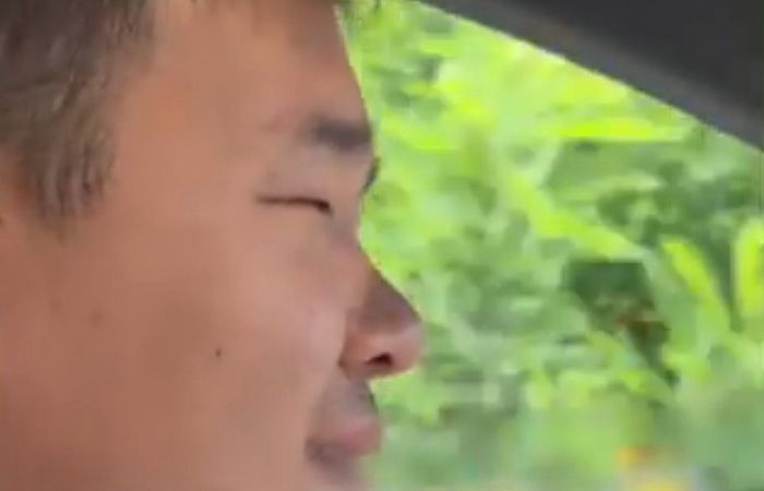 눈 떴는데도 너무 작아 운전대만 잡으면 ‘졸음운전 경고음’ 시달리는 남성 (영상)