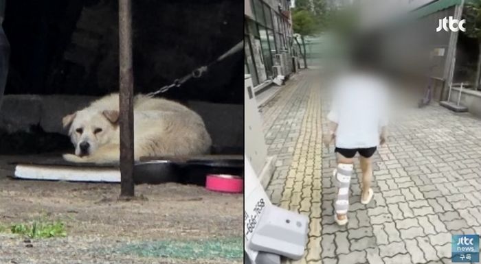 카센터에 묶여 있던 대형견에 ‘개물림 사고’ 당해... “전치 6주 중상을 입었습니다” (영상)