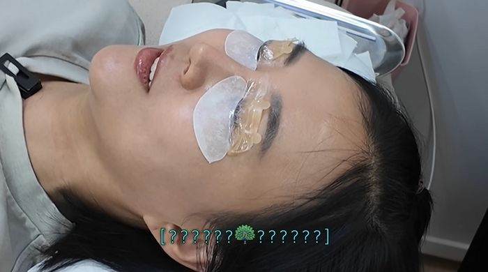 장윤정, ‘이 시술’ 받고 눈 커졌다... 시술 장면 쿨하게 공개 (영상)
