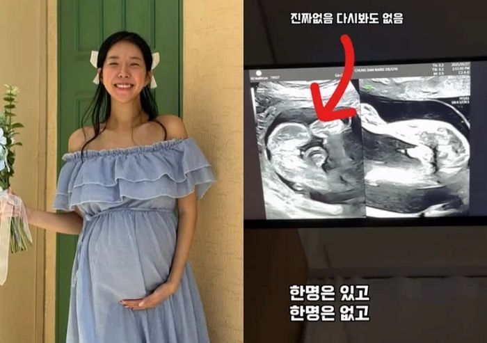‘아들 쌍둥이 임신’ 김지혜, 기적 일어났다... “딸·아들 쌍둥이로 바뀌어”