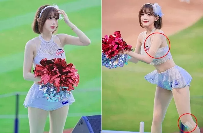 인사이트