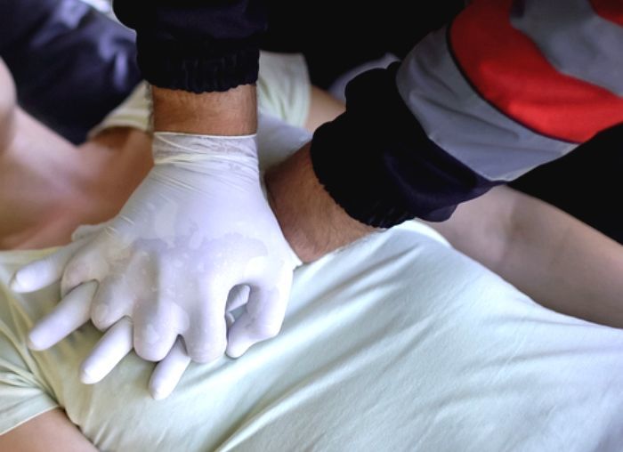 쓰러진 여성 심폐소생술로 살려낸 中 의대 교수... SNS에 영상 공개된 뒤 성추행범으로 낙인 찍혀