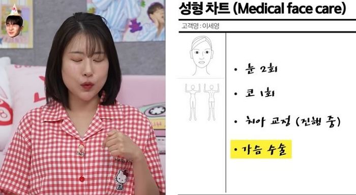 연예계 ‘성형권위자’라고 자처한 이세영 “월급 3000만원 성형외과 상담실장 제안 받았다”
