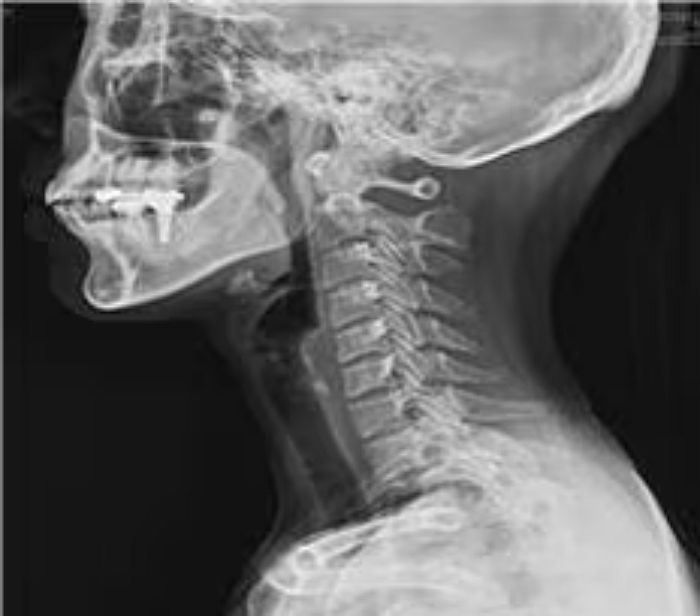 10대들 사이서 급증하고있는 ‘VDT 증후군’ 원인 봤더니