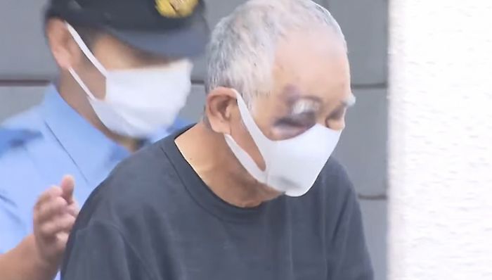 “더는 못 맞겠다”... ‘아들 살해 미수’ 日 아버지, 얼굴에 ‘멍자국’ 선명