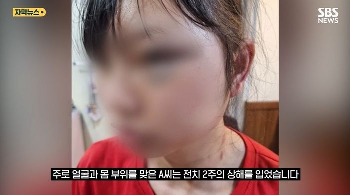 “날 무시해?”... 20대 베트남 여성 노동자 폭행한 40대 남성