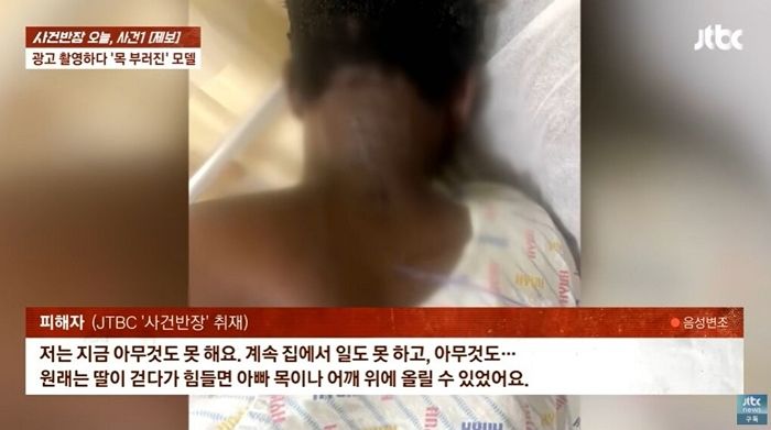 국내 카드사 광고 찍다 목 부러진 외국인 모델... “사고는 불운... 우리 과실 없어”