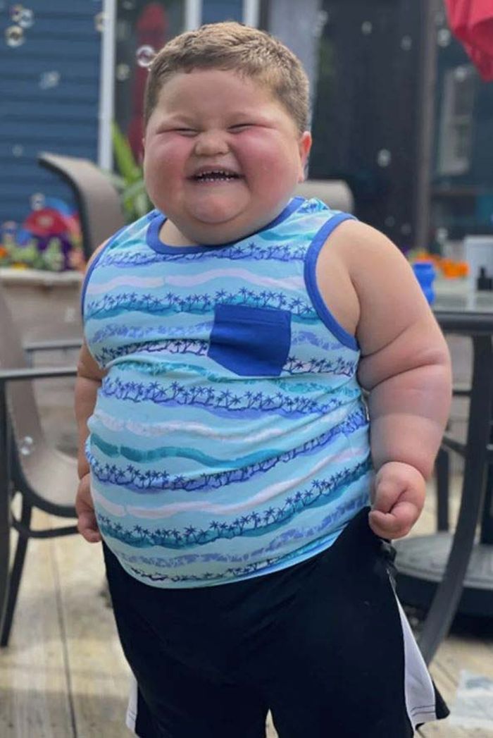 시도때도 없이 “밥 줘”... 45kg까지 살찐 3살 아이, 알고보니 ‘이 병’ 환자?