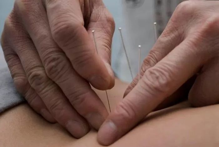 “48cm 장침으로...” 치매·암 환자들에 불법 침 시술한 76세 ‘가짜 한의사’