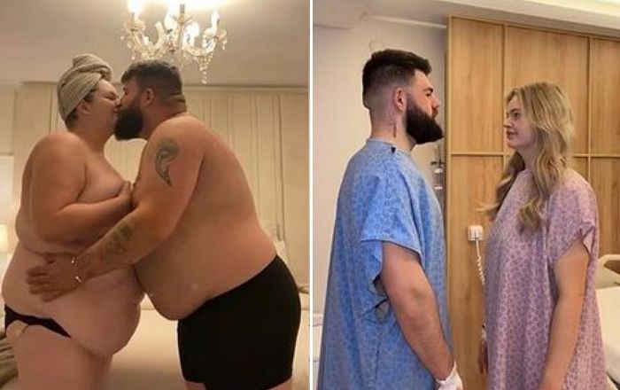 결혼자금 다 털어 ‘비만 수술’ 받은 커플... 둘이서 152kg 빼고 ‘새 인생’ 얻었다