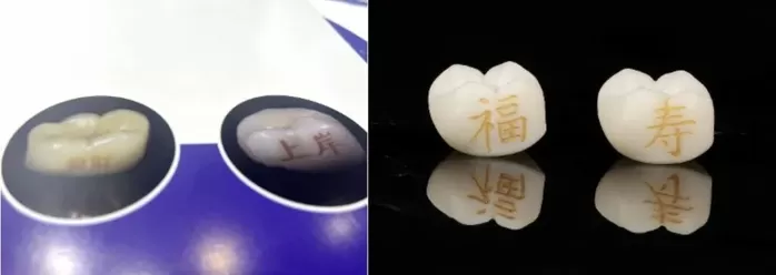 중국 젊은층 사이 소망 새기는 ‘치아 문신’ 열풍... “피부 문신은 구식”