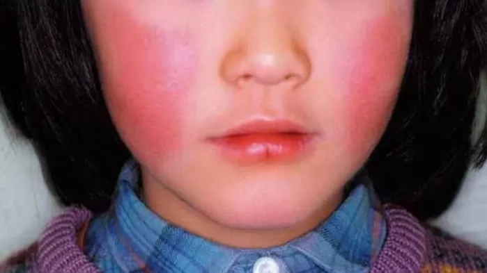 임산부에게 치명적인 ‘이 병’... 한국인들 자주 가는 日 휴양지서 확산 중