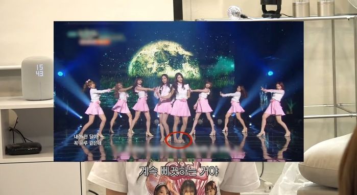 밑창 없는 구두 때문에 넘어져 인대 파열됐던 미주... 소속사 관계자가 한 충격적인 말