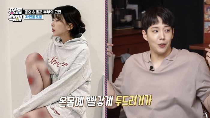 ‘배우♥아이돌’ 부부, 결혼 2년만 심각한 상황 전해... “소리만 들어도 두드러기가 날 정도”