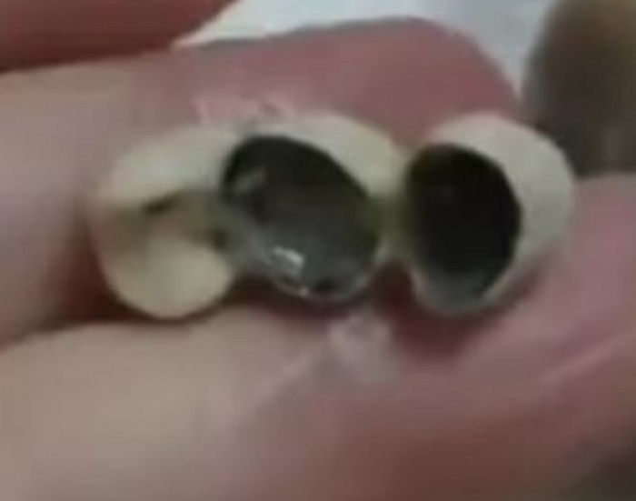 소시지·딤섬 먹다가 느껴진 다른 식감, 뱉고 보니 ‘인공치아’... 중국인들 충격 빠졌다