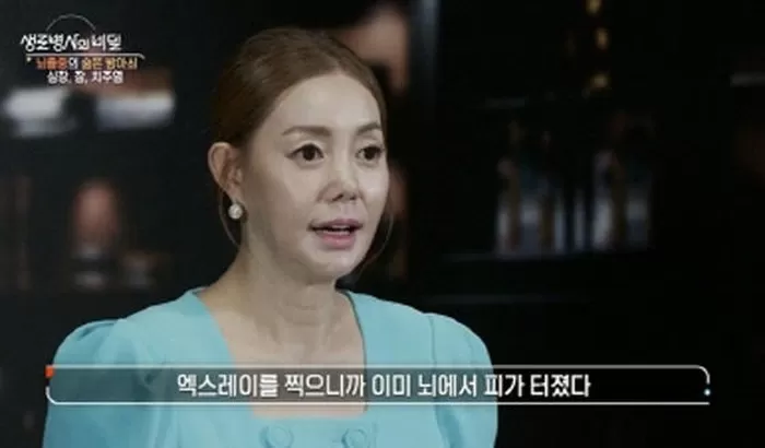 가수 박규리 34세에 뇌출혈 진단...뇌에서 피가 터져 생명 위급 (생로병사의 비밀)