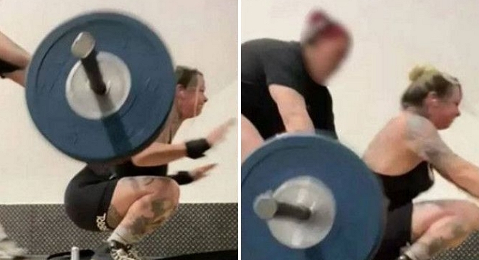 120kg 바벨 들고 스쿼트하다 ‘뽀각’... 발몰 골절된 30대 여성