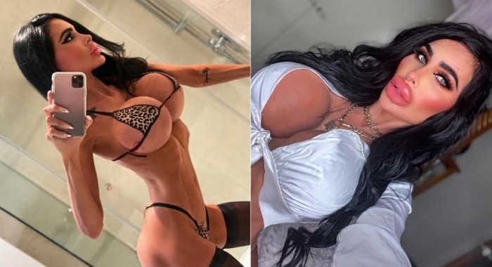 ‘인간 바비’ 되려고 성형수술에 2억 쏟아 부은 간호사의 실제 모습... “갈비뼈 제거할 것”