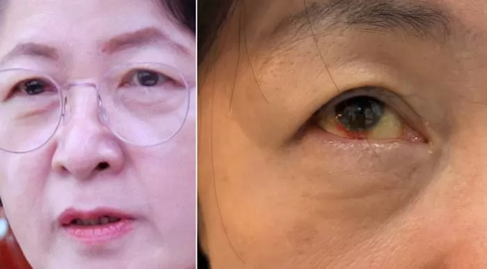 Facebook '추미애'