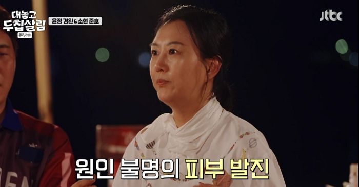 장윤정, 10개월째 이어진 건강 이상... “원인 모를 발진에 심적으로도 지쳐”