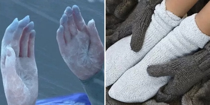 가만히 있어도 손 시린 겨울철 필수!... ‘수족냉증’ 완화시켜주는 10분 루틴