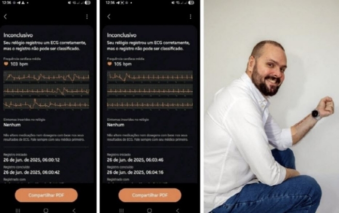 “고마워요 삼성”... ‘갤워치’로 목숨 건진 브라질 남성, 삼성에 감사편지 보냈다