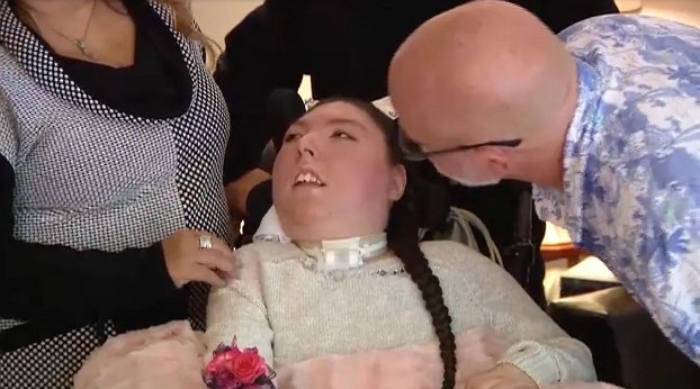 “4살 이상 생존 불가능”... 뇌 없이 태어난 ‘무뇌증’ 여성, 예상 뛰어넘고 20살 생일 맞았다