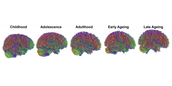 인간의 뇌, 평생 네 번 ‘대전환’ 맞는다... 9세·32세·66세·83세가 결정적 시기
