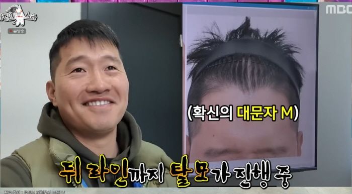 ‘개통령’ 강형욱, 갑질 주장에 스트레스받아 앞탈모... “주사 맞고 흑채 뿌려”