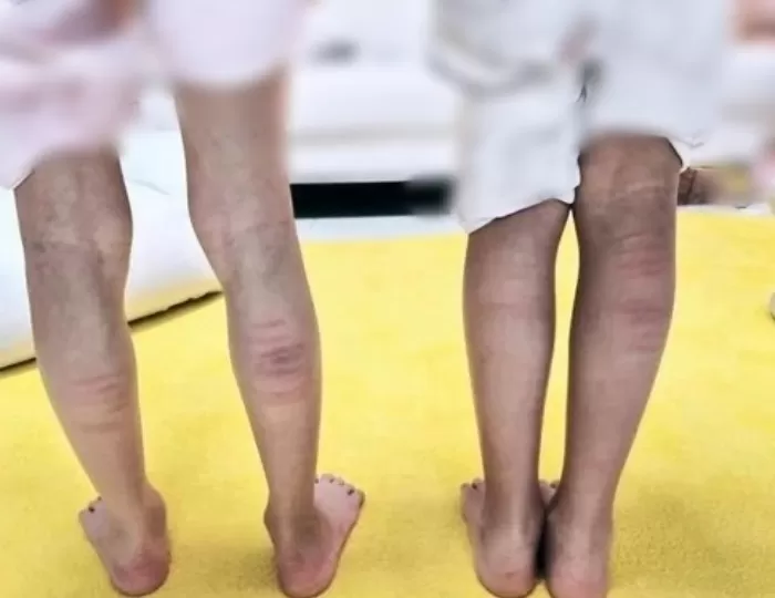 한 여성이 자녀를 때리고 이를 사진으로 SNS(소셜미디어)에 인증해 아동학대 논란에 휘말렸다. /사진=스레드 캡처