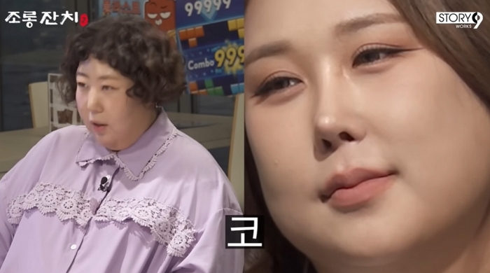 25kg 감량한 풍자, 5번째 코 성형 후 확 달라진 근황... “더 뺄 것”