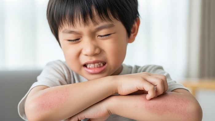아토피 아이도 라면 먹어도 될까? 전문가가 제시하는 안전한 섭취 기준과 조리법
