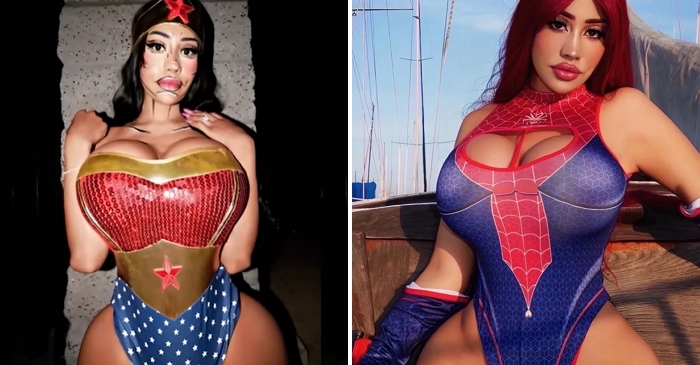 “허리 줄이려 갈비뼈까지”... 320만 팔로워 모델, 성형에만 1.5억 쏟아부어