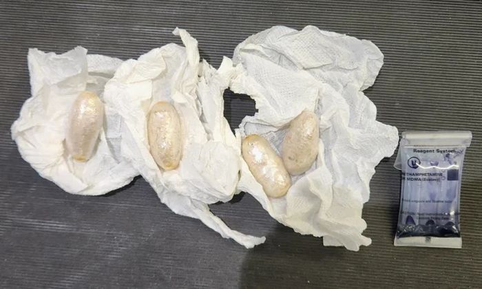 신체 은밀 부위에 5800명분 마약 숨긴 네덜란드인 검거... 충격 수법