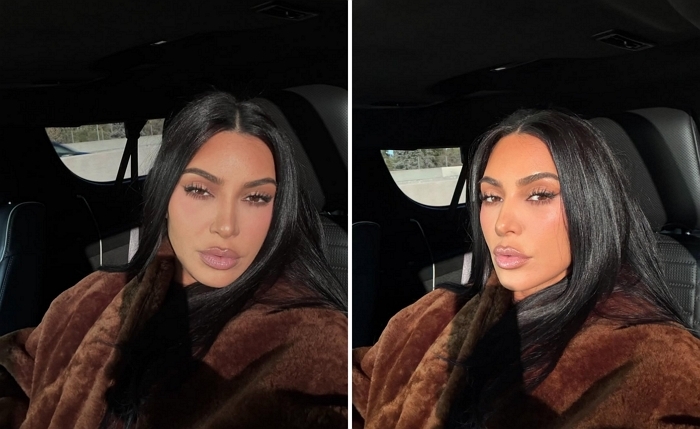 헐리웃 스타 킴 카다시안 뇌에 ‘구멍’ 진단?... 전문가가 밝힌 검사 결과의 진짜 의미