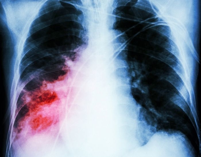 기사의 이해를 돕기 위한 자료 사진 / gettyimagesBank