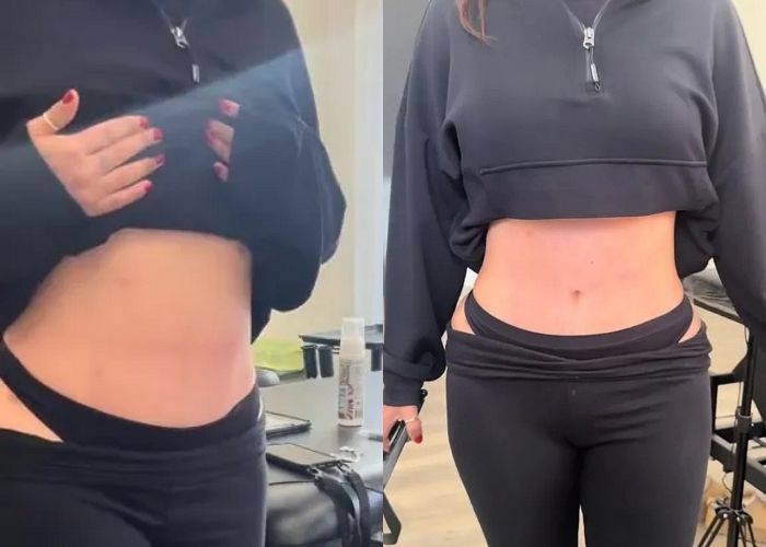 복부 성형에 배꼽 잃은 친구 위해... SNS서 화제된 ‘타투’ 선물