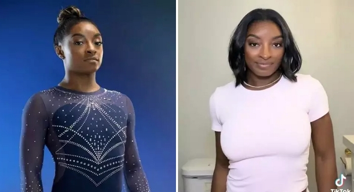 “변화 놀랍죠?”... 가슴 확대 수술 전후 당당하게 공개한 미국 체조 여신 (영상)