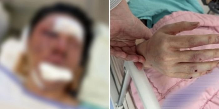 ‘납치·살인미수’ 딛고 일어선 유튜버 수탉... “인생 아까워, 무기력하게 있지 않겠다” 복귀 선언