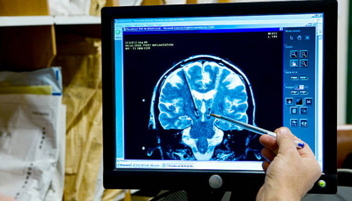 '대두'로 태어난 친구들이 더 '똑똑'하고 성공할 확률 높다