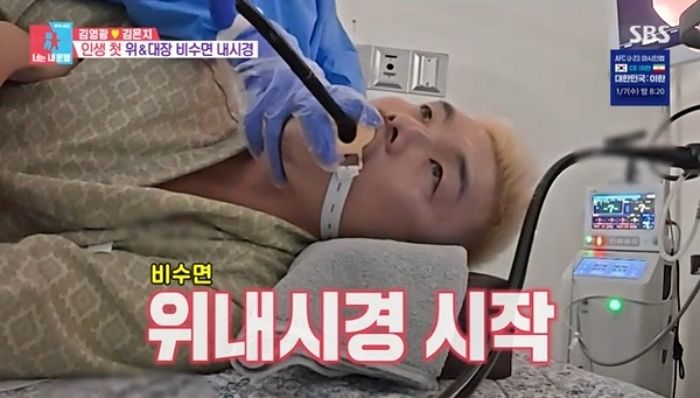 “구라 선배님 감사”... 김영광, 비수면 내시경 검사 중 ‘암 위험’ 용종 발견