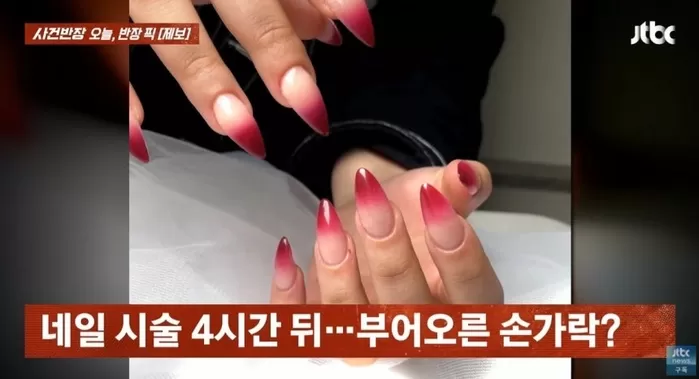 네일 시술을 받은 한 외국인 여성이 손가락에 문제가 생긴 것처럼 조작한 인공지능(AI) 이미지로 환불과 진료비를 요구했다는 사연이 전해졌다. /사진=JTBC 사건반장 캡처