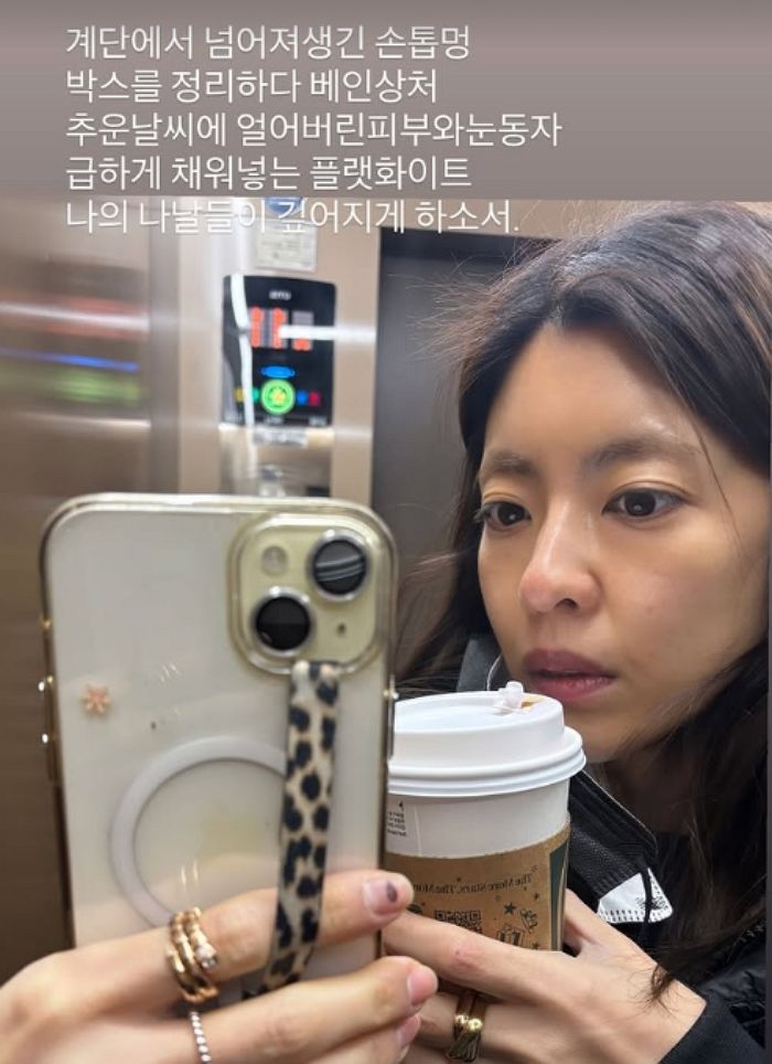 “계단서 넘어져 손톱에 멍”... 이윤지가 공개한 소소한 일상