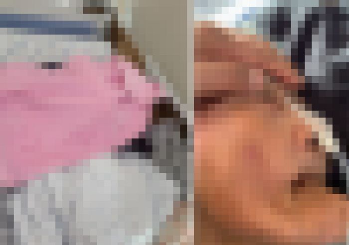 노모 얼굴에 ‘수건’ 덮고 방치한 요양병원... 책임 묻자 “누가 그랬는지 모른다”