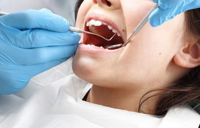 사랑니 발치,치과 치료,진화의 결과,인간 진화,진화 과정