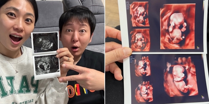 펜싱 김지연♥ 배우 이동진, 결혼 9년만에 쌍둥이 임신... “태명은 럭키 비키”