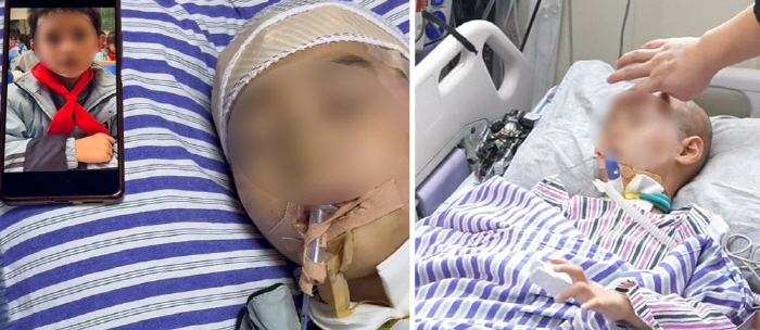 “빨리 돌아와” 친구들 영상에 반응... 혼수상태 8살 소년에게 일어난 55일 만의 기적