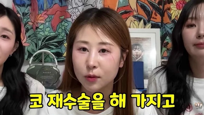 박세미, ‘들창코 성괴’ 악플에 코 재수술 고백... “이제 들창코 아냐”